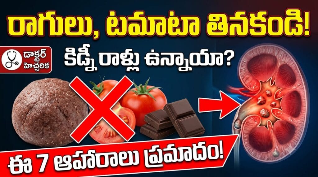 Foods to avoid for kidney stones – ragi, cashew, pomegranate, dark chocolate, tomato, peanuts, amaranth high oxalate foods.