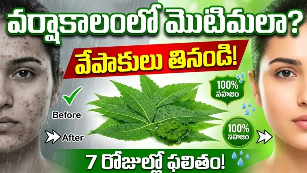 Neem leaves for acne treatment – natural remedy for monsoon skin problems, blood purification, antibacterial benefits.