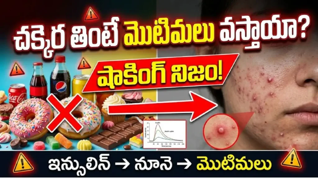 Sugar and acne connection – how sugary foods, insulin spikes, and inflammation cause pimples and affect skin health.